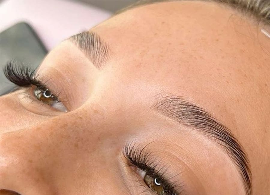 Brow correction result
